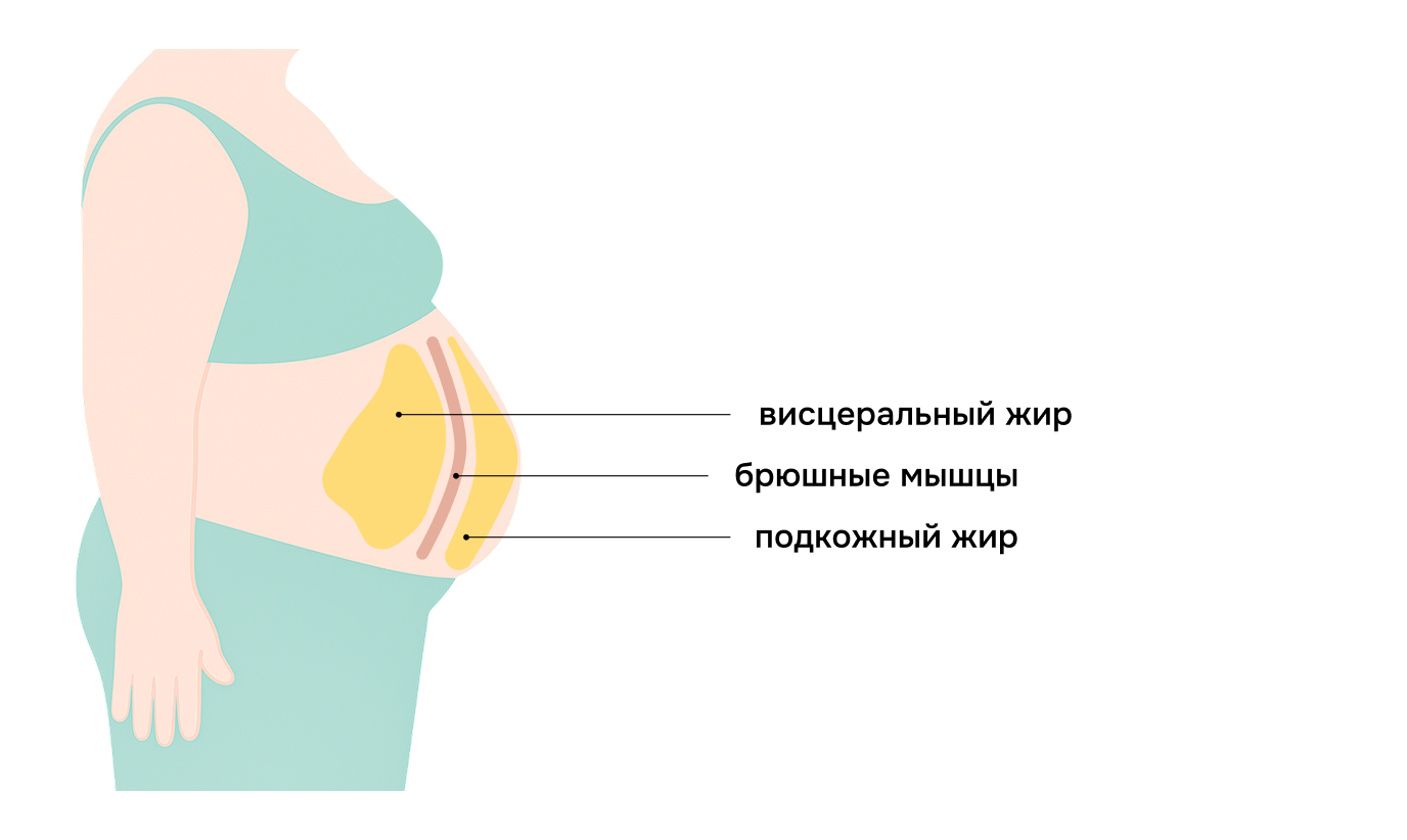 висцеральный жир; брюшные мышцы; подкожный жир